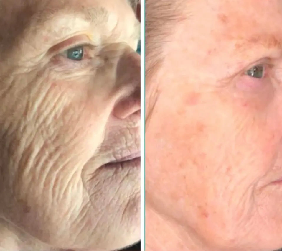 FacePro™ : Appareil Massage du visage 4 en 1 - Luminary Beaute