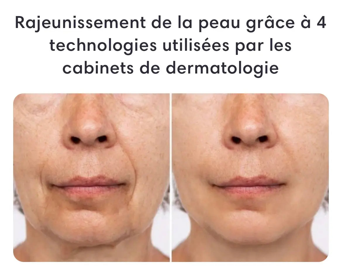 FacePro™ : Appareil Massage du visage 4 en 1 - Luminary Beaute